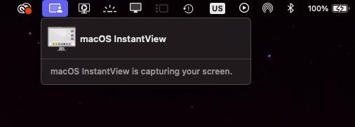 InstantView Recording